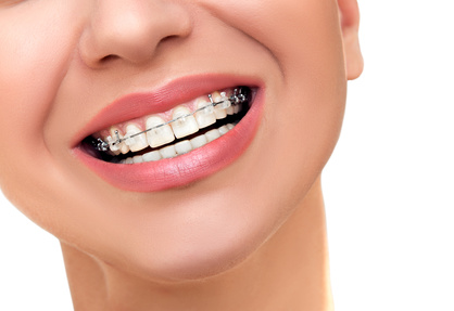 Orthodontics